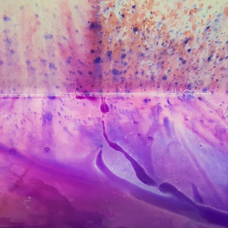 Artwork: Gink Yang - Watercolours of Pathology
